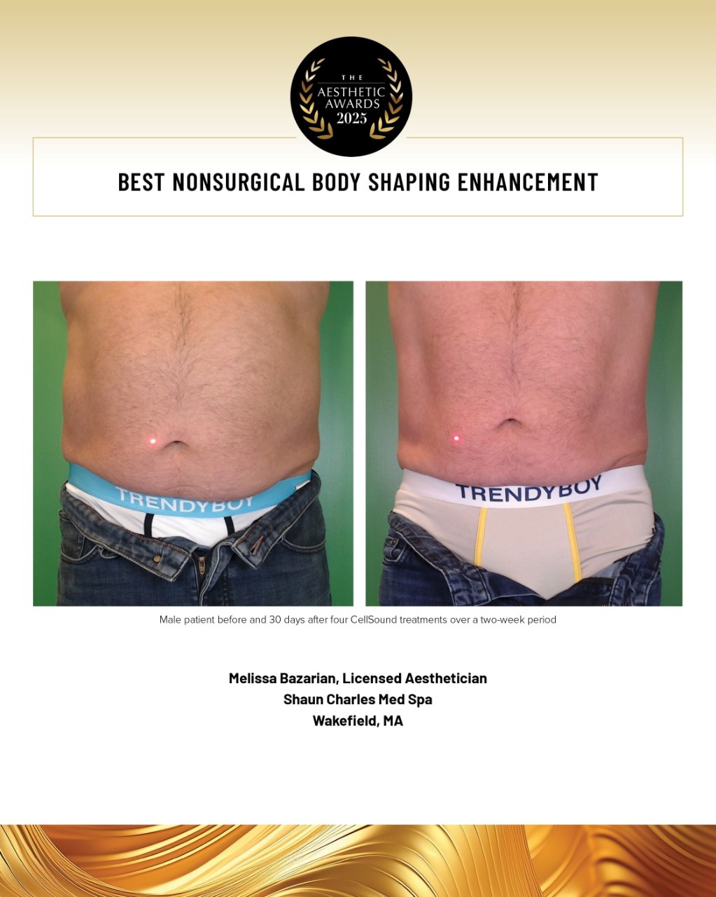 nonsurgical body