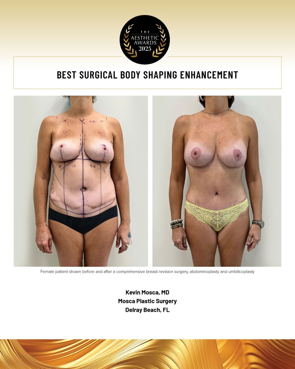 surgical body