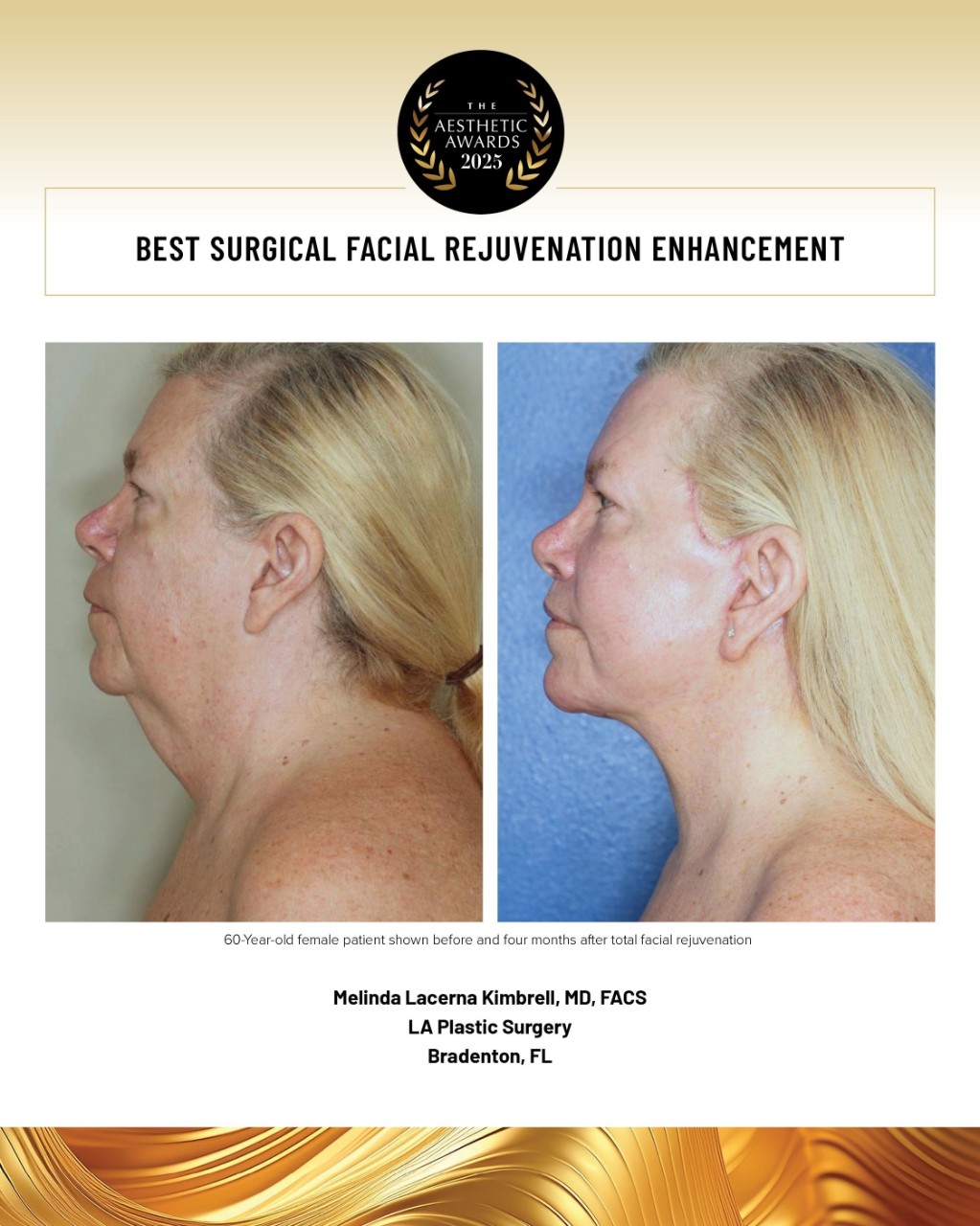 surgical facial