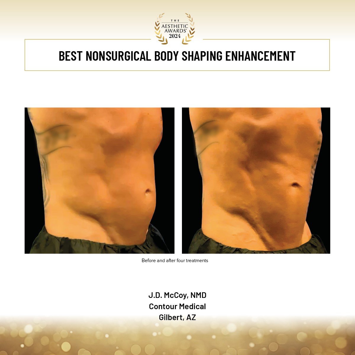 Best Nonsurg Body Shaping